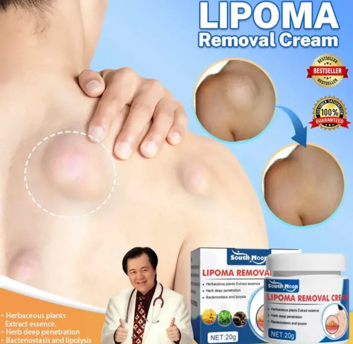 Lepoma Removal Cream