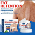 Lepoma Removal Cream