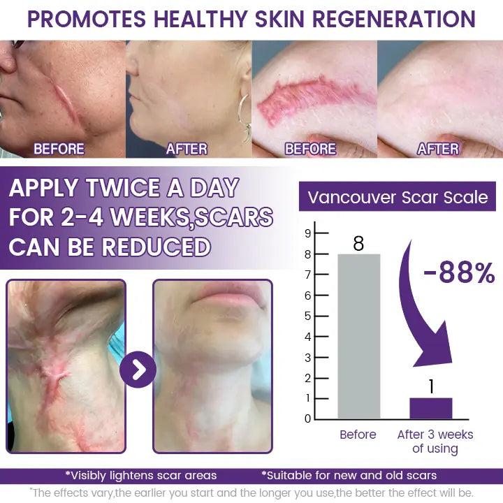 Timilk Regenscar Gel