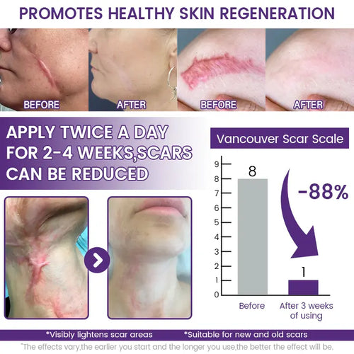 Timilk Regenscar Gel